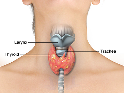 Thyroid Disorders