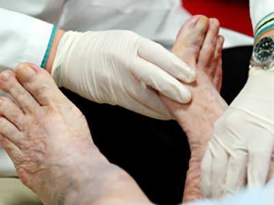 Diabetic Foot Care