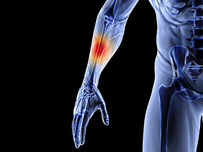 Work Related Hand Injuries